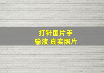 打针图片手 输液 真实照片